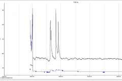 Sensores (5)